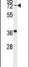 Coiled-coil domain-containing protein 38 antibody, PA5-24141, Invitrogen Antibodies, Western Blot image 