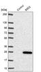 B9 Domain Containing 2 antibody, PA5-60050, Invitrogen Antibodies, Western Blot image 