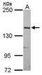 Alpha-2-Macroglobulin antibody, PA5-29584, Invitrogen Antibodies, Western Blot image 
