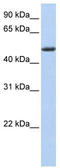 Pleckstrin homology-like domain family A member 1 antibody, TA334415, Origene, Western Blot image 