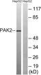 P21 (RAC1) Activated Kinase 2 antibody, LS-C199403, Lifespan Biosciences, Western Blot image 