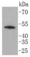 Lymphocyte-specific protein 1 antibody, A02992-1, Boster Biological Technology, Western Blot image 