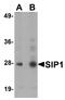 Gem Nuclear Organelle Associated Protein 2 antibody, A04530, Boster Biological Technology, Western Blot image 