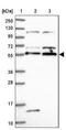 Acrosin Binding Protein antibody, NBP1-85407, Novus Biologicals, Western Blot image 