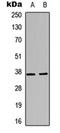CD1d Molecule antibody, orb315763, Biorbyt, Western Blot image 