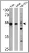 Peroxisome Proliferator Activated Receptor Alpha antibody, GTX12412, GeneTex, Western Blot image 