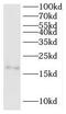 SNAP Associated Protein antibody, FNab08060, FineTest, Western Blot image 
