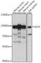 Elongator Acetyltransferase Complex Subunit 2 antibody, A15857, ABclonal Technology, Western Blot image 