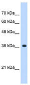 Alpha-1,4-N-Acetylglucosaminyltransferase antibody, TA342001, Origene, Western Blot image 