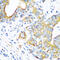 Mitochondrially Encoded Cytochrome C Oxidase II antibody, 14-041, ProSci, Immunohistochemistry paraffin image 