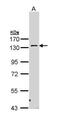 Protein Kinase N2 antibody, PA5-22181, Invitrogen Antibodies, Western Blot image 