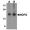HOP Homeobox antibody, TA349158, Origene, Western Blot image 