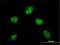 DPY30 Domain Containing 1 antibody, H00143241-M01, Novus Biologicals, Immunocytochemistry image 