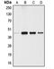 Angiopoietin-related protein 4 antibody, LS-C353450, Lifespan Biosciences, Western Blot image 
