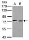 Cytochrome P450 Family 4 Subfamily F Member 2 antibody, PA5-27769, Invitrogen Antibodies, Western Blot image 