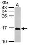 Ribonuclease UK114 antibody, GTX119107, GeneTex, Western Blot image 