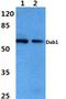 Disabled homolog 1 antibody, LS-B10915, Lifespan Biosciences, Western Blot image 
