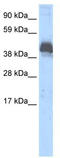 Zinc Finger And BTB Domain Containing 43 antibody, TA331986, Origene, Western Blot image 