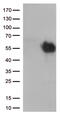 Hepatitis A Virus Cellular Receptor 2 antibody, CF812571, Origene, Western Blot image 
