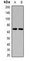 Butyrylcholinesterase antibody, orb377946, Biorbyt, Western Blot image 