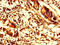 Stromal membrane-associated protein 1 antibody, orb356839, Biorbyt, Immunohistochemistry paraffin image 