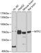 Metal-response element-binding transcription factor 2 antibody, GTX33330, GeneTex, Western Blot image 