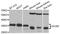 Dicarbonyl And L-Xylulose Reductase antibody, A4721, ABclonal Technology, Western Blot image 