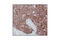 Keratin 18 antibody, 4546P, Cell Signaling Technology, Immunohistochemistry paraffin image 