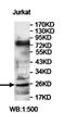 Ankyrin Repeat Domain 49 antibody, orb78101, Biorbyt, Western Blot image 
