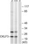 CKLF-like MARVEL transmembrane domain-containing protein 3 antibody, abx014367, Abbexa, Western Blot image 