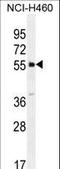 Shisa Family Member 6 antibody, LS-C203699, Lifespan Biosciences, Western Blot image 