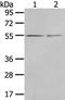 Chordin Like 1 antibody, PA5-50893, Invitrogen Antibodies, Western Blot image 