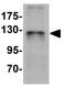 Zinc finger and BTB domain-containing protein 4 antibody, GTX31998, GeneTex, Western Blot image 