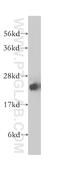 Stathmin 4 antibody, 12027-1-AP, Proteintech Group, Western Blot image 