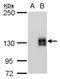 mCherry Tag  antibody, NBP2-43768, Novus Biologicals, Western Blot image 