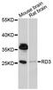Retinal Degeneration 3, GUCY2D Regulator antibody, LS-C748225, Lifespan Biosciences, Western Blot image 
