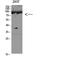 CD168 antibody, STJ98724, St John