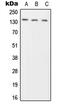Phogrin antibody, MBS821246, MyBioSource, Western Blot image 