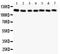 Zinc finger protein GLI1 antibody, PB9108, Boster Biological Technology, Western Blot image 