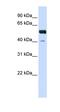 Zinc finger protein 703 antibody, orb329733, Biorbyt, Western Blot image 