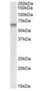 Tetratricopeptide Repeat Domain 8 antibody, orb20541, Biorbyt, Western Blot image 