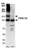 FKBP Prolyl Isomerase 15 antibody, A300-210A, Bethyl Labs, Western Blot image 
