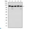 Bone Morphogenetic Protein Receptor Type 2 antibody, LS-C812516, Lifespan Biosciences, Enzyme Linked Immunosorbent Assay image 