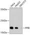 Peptidylprolyl Isomerase B antibody, 13-910, ProSci, Western Blot image 