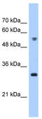 Tetratricopeptide repeat protein 5 antibody, TA329576, Origene, Western Blot image 