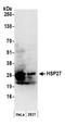 Heat Shock Protein Family B (Small) Member 1 antibody, A304-710A, Bethyl Labs, Western Blot image 