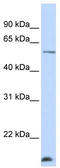 DDB1 And CUL4 Associated Factor 12 antibody, TA339195, Origene, Western Blot image 