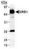 Scavenger Receptor Class B Member 1 antibody, TA301489, Origene, Western Blot image 