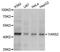 Tyrosyl-TRNA Synthetase 2 antibody, A4706, ABclonal Technology, Western Blot image 