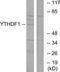 YTH N6-Methyladenosine RNA Binding Protein 1 antibody, TA315549, Origene, Western Blot image 